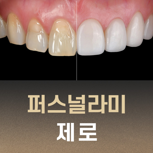 시안2.jpg